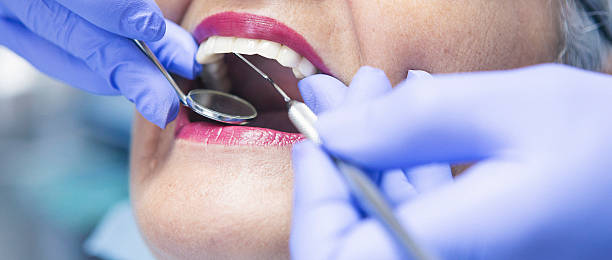 Best Broken or Cracked Tooth Emergency Dentist in Fallsburg, NY